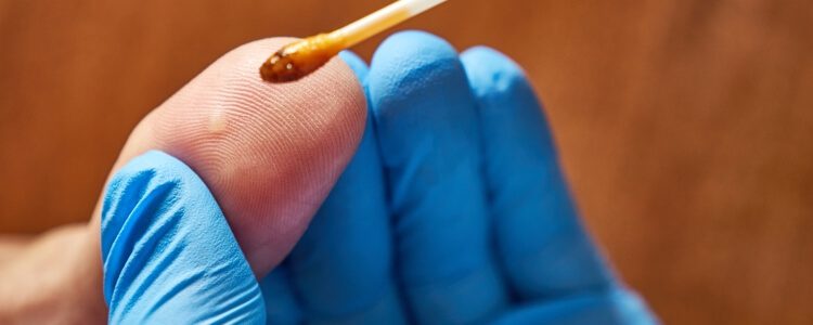 Plantar wart treatment