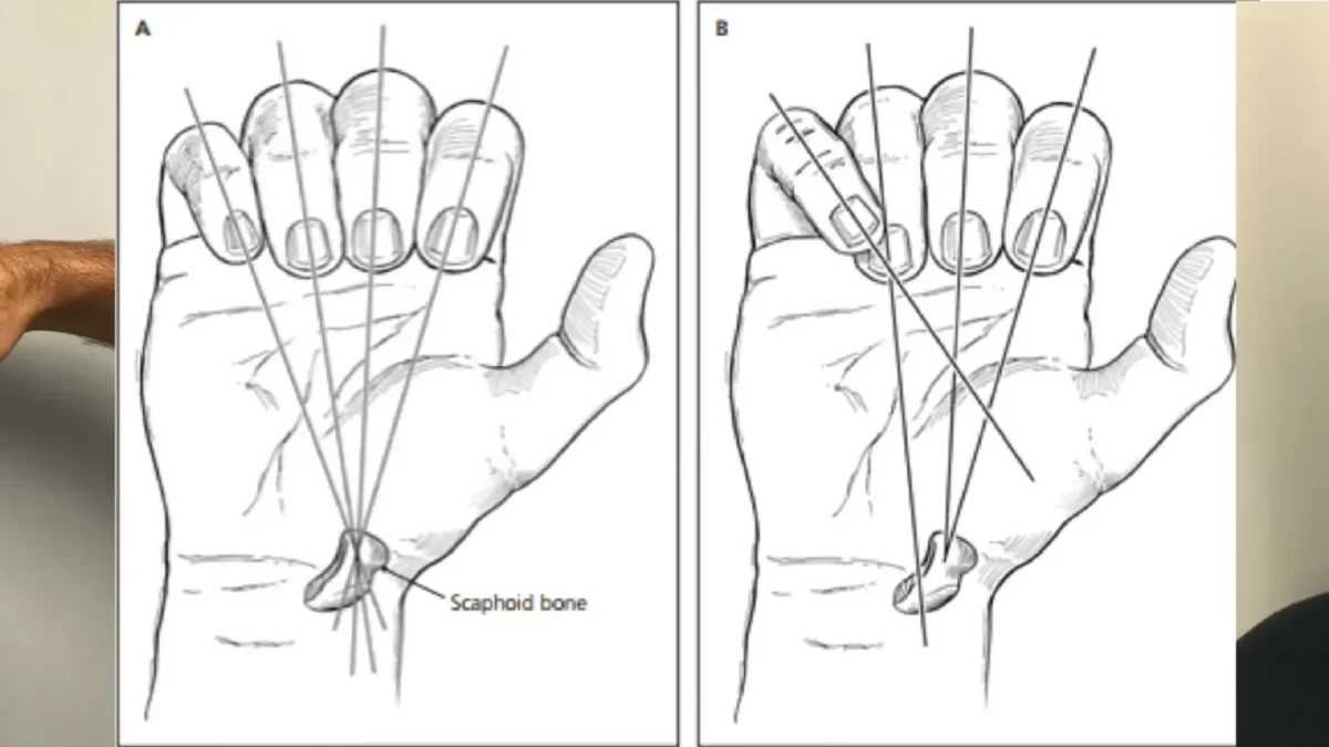 Strapping :: Wamberal Physiotherapy